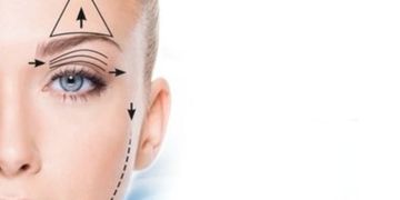 La blépharoplastie médicale VS blépharoplastie chirurgicale