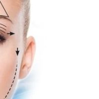 La blépharoplastie médicale VS blépharoplastie chirurgicale