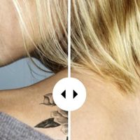 Le détatouage au laser : une méthode avancée pour effacer les tatouages en toute sécurité