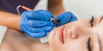 Épilation Électrique : La solution permanente pour une peau lisse et sans poils