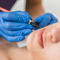 Épilation Électrique : La solution permanente pour une peau lisse et sans poils