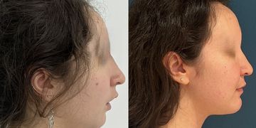 La chirurgie orthognathique : quand l’harmonie crée la beauté