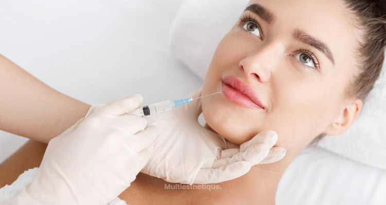 Acide hyaluronique : préserver l’harmonie du visage sans le transformer
