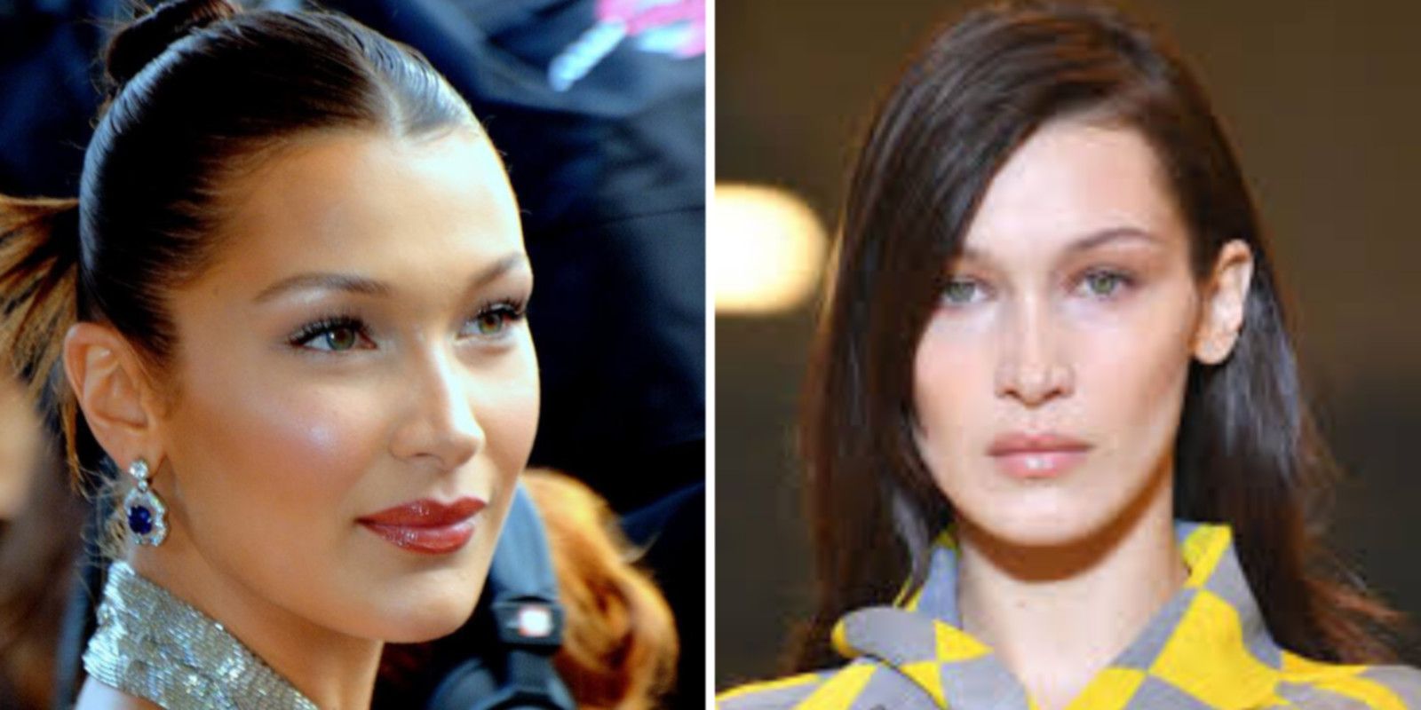 Bella Hadid bichectomie avant / après