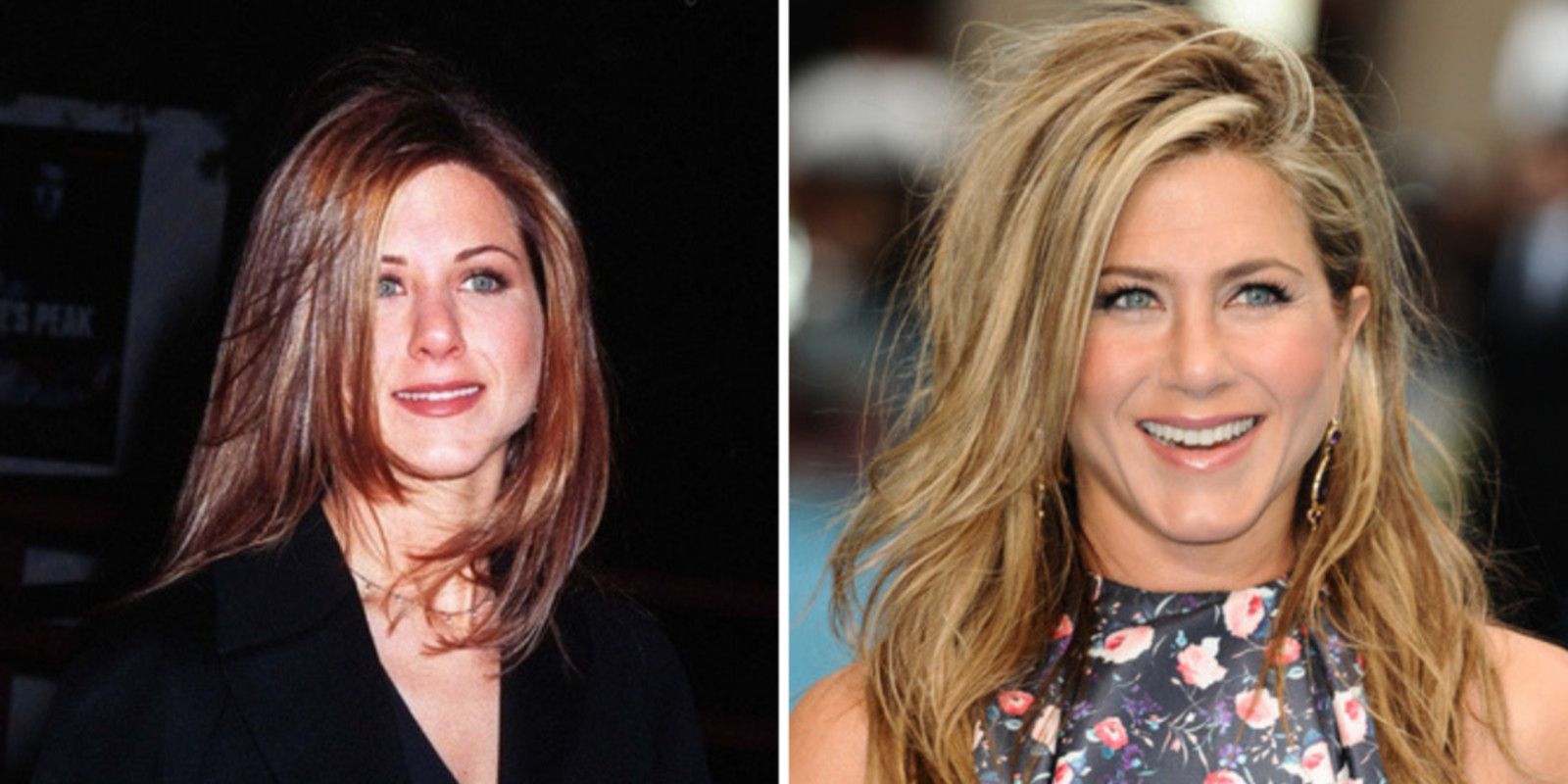 Jennifer Aniston Bichectomie Avant / Après