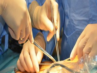 Surgicart