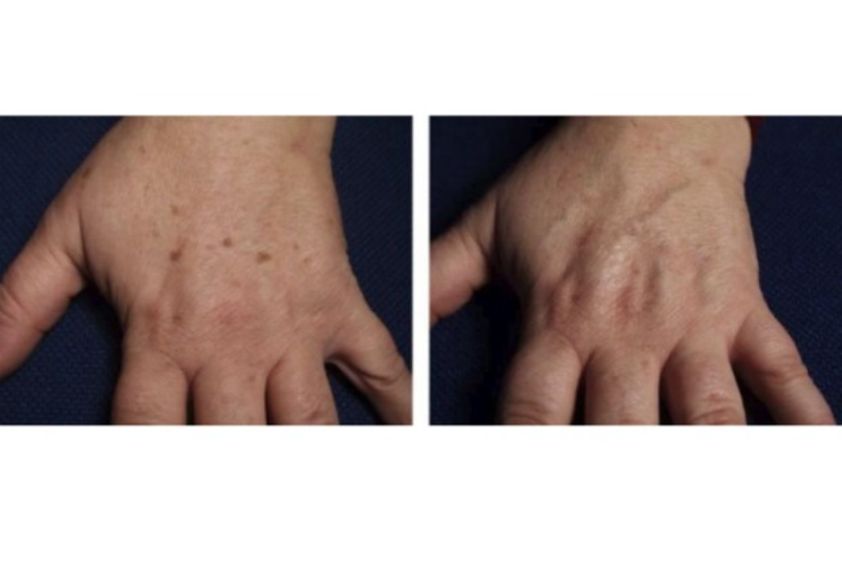 Chirurgie reconstructrice avant et après - 559876