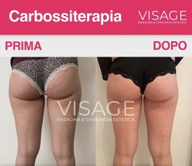 Visage - Médecine et chirurgie esthétique