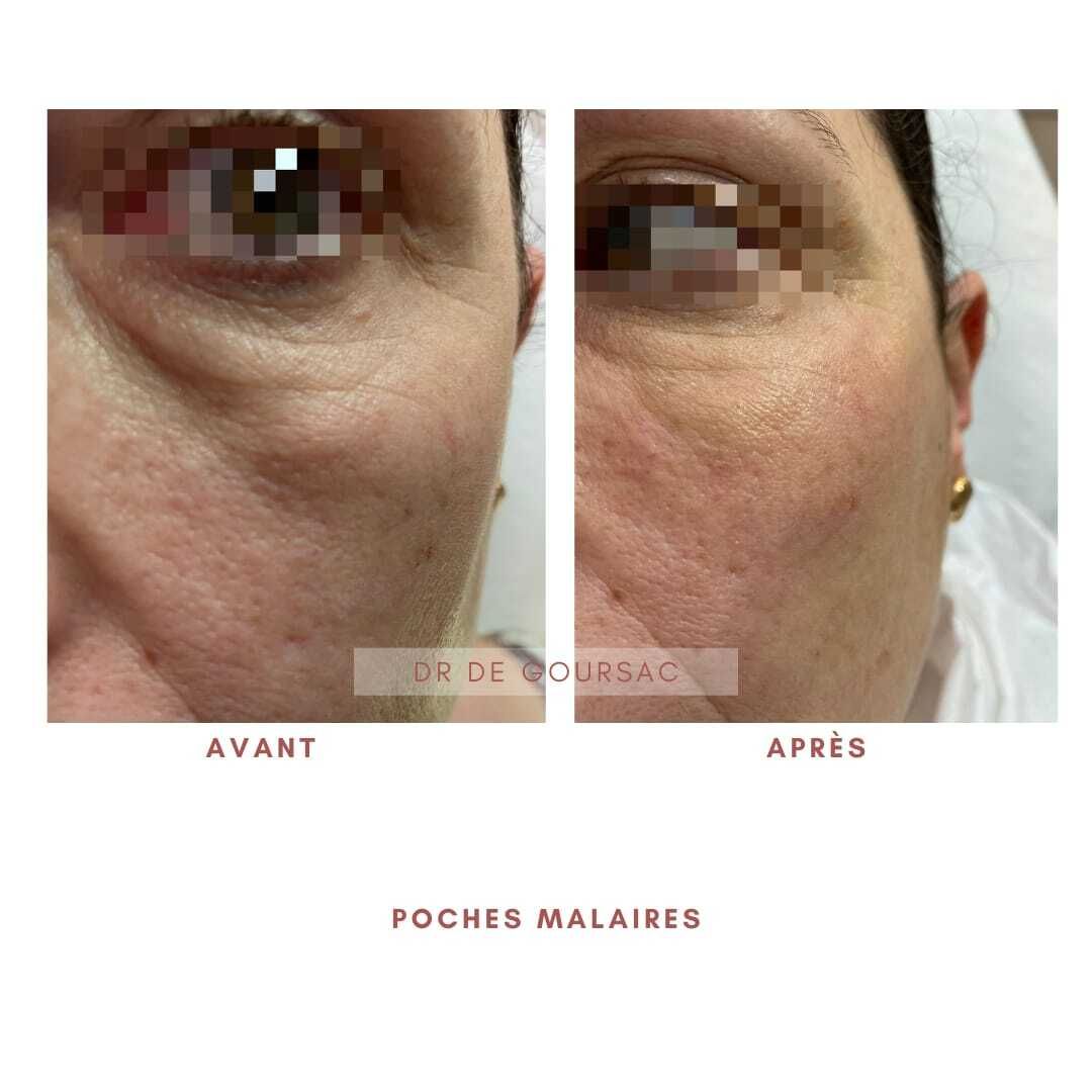 Dr Catherine de Goursac Multiesthetique.fr — free download
