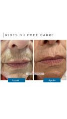 Rides du code barre - Dr De Goursac