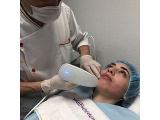Épilation Laser - Dr Didier Dubois
