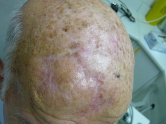 Chirurgie reconstructrice - 635966