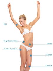 INDICATIONS CRYOLIPOLYSE