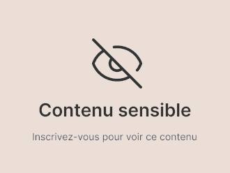 Augmentation mammaire avant et après - 880587