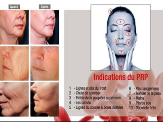Traitement capillaire - 565897