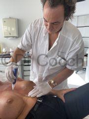 Microneedling - Dr Christian Cocchi