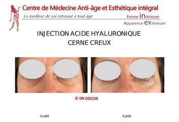 Cernes - Dr Christian Cocchi