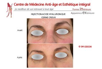 Cernes - Dr Christian Cocchi