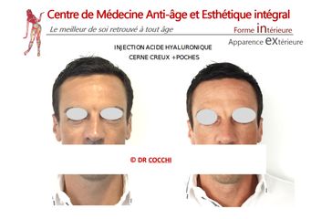 Cernes - Dr Christian Cocchi