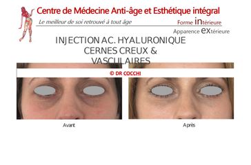 Cernes - Dr Christian Cocchi