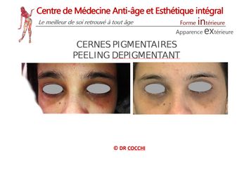 Cernes - Dr Christian Cocchi