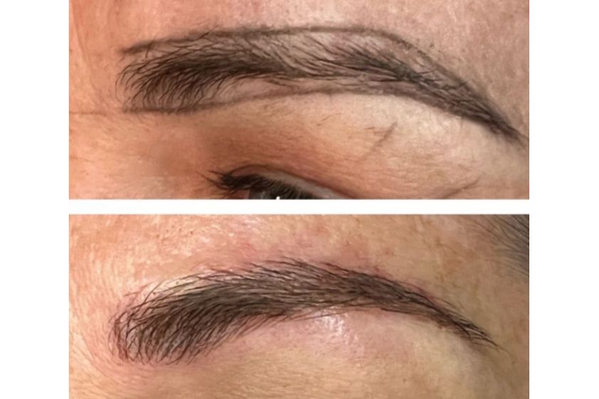 Dermopigmentation avant et après - 817431