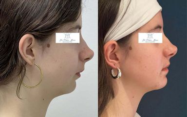 chirurgie Maxillo-faciale Dr Frédéric Barère