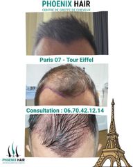 Paris 07 - PHC (Instagram Post (45))