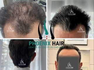 Phoenix Hair Center Paris