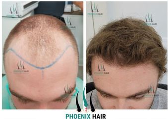 Phoenix Hair Center Paris