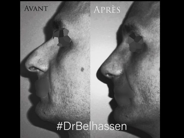 Dr Farès Belhassen - Multiesthetique.fr