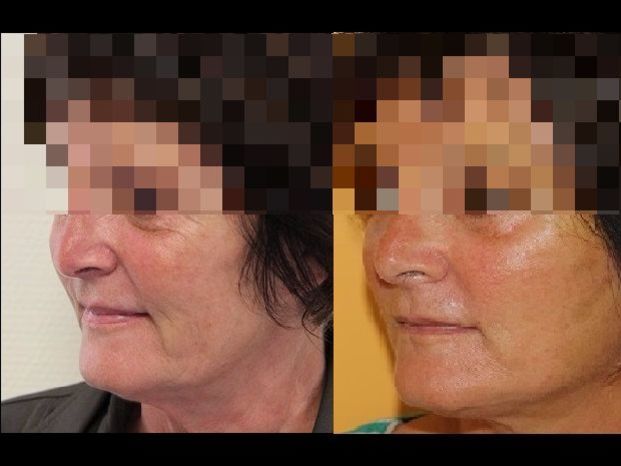 Dr Farès Belhassen - Multiesthetique.fr