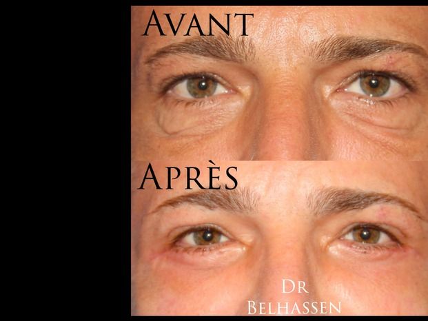 Dr Farès Belhassen - Multiesthetique.fr