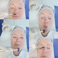 Dr Catherine Pannacci - Mandelieu Esthétique