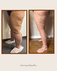 lacliniquedulipoedeme.fr