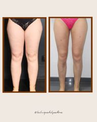 lacliniquedulipoedeme.fr