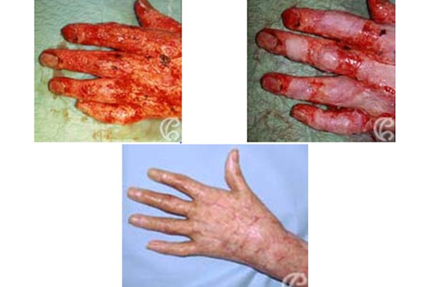 Chirurgie reconstructrice avant et après - 549181