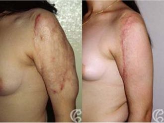 Chirurgie reconstructrice avant et après - 549182
