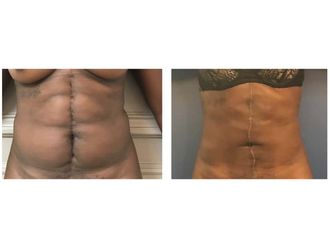 Chirurgie reconstructrice avant et après - 633572
