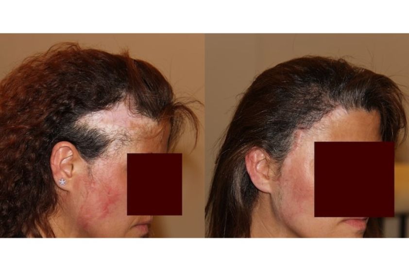 Chirurgie reconstructrice avant et après - 633573