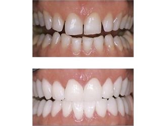 Chirurgie maxillo-faciale - 543663