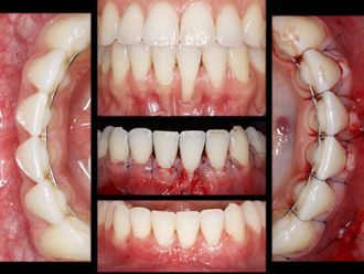 Chirurgie maxillo-faciale - 850104