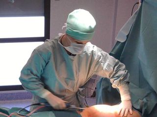 Liposuccion abdominale