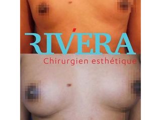 Augmentation mammaire - Dr Juan Carlos Rivera