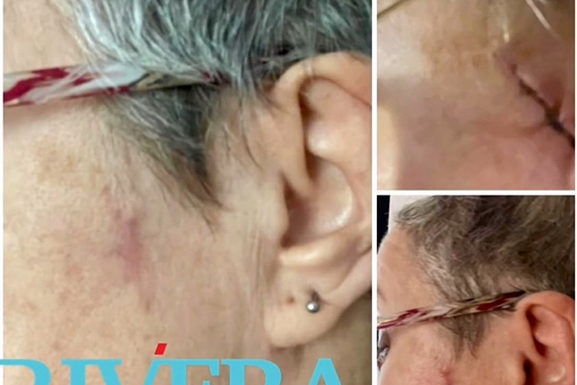 Chirurgie reconstructrice avant et après - 862760