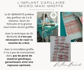 Implants capillaires - Dr Alain Berkovits