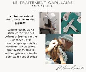 Traitement capillaire - Dr Alain Berkovits