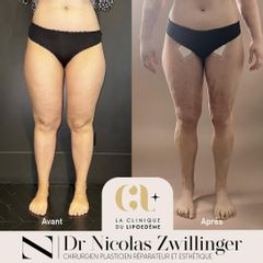 La Clinique du Lipœdème