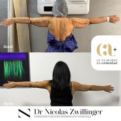 La Clinique du Lipœdème