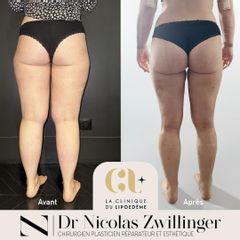 La Clinique du Lipœdème